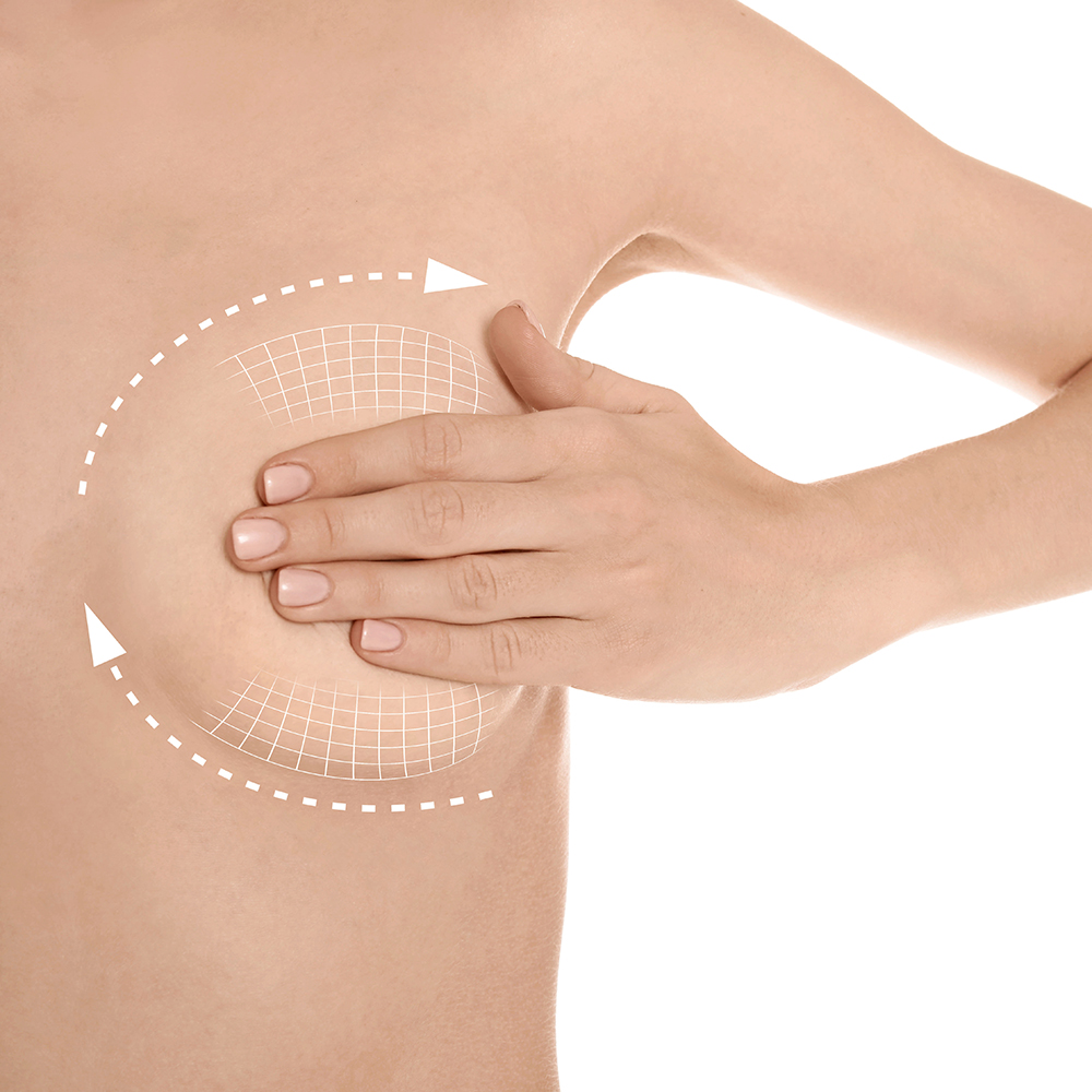 Asymétrie mammaire - Chirurgie Esthétique - Nice - Docteur Buffet